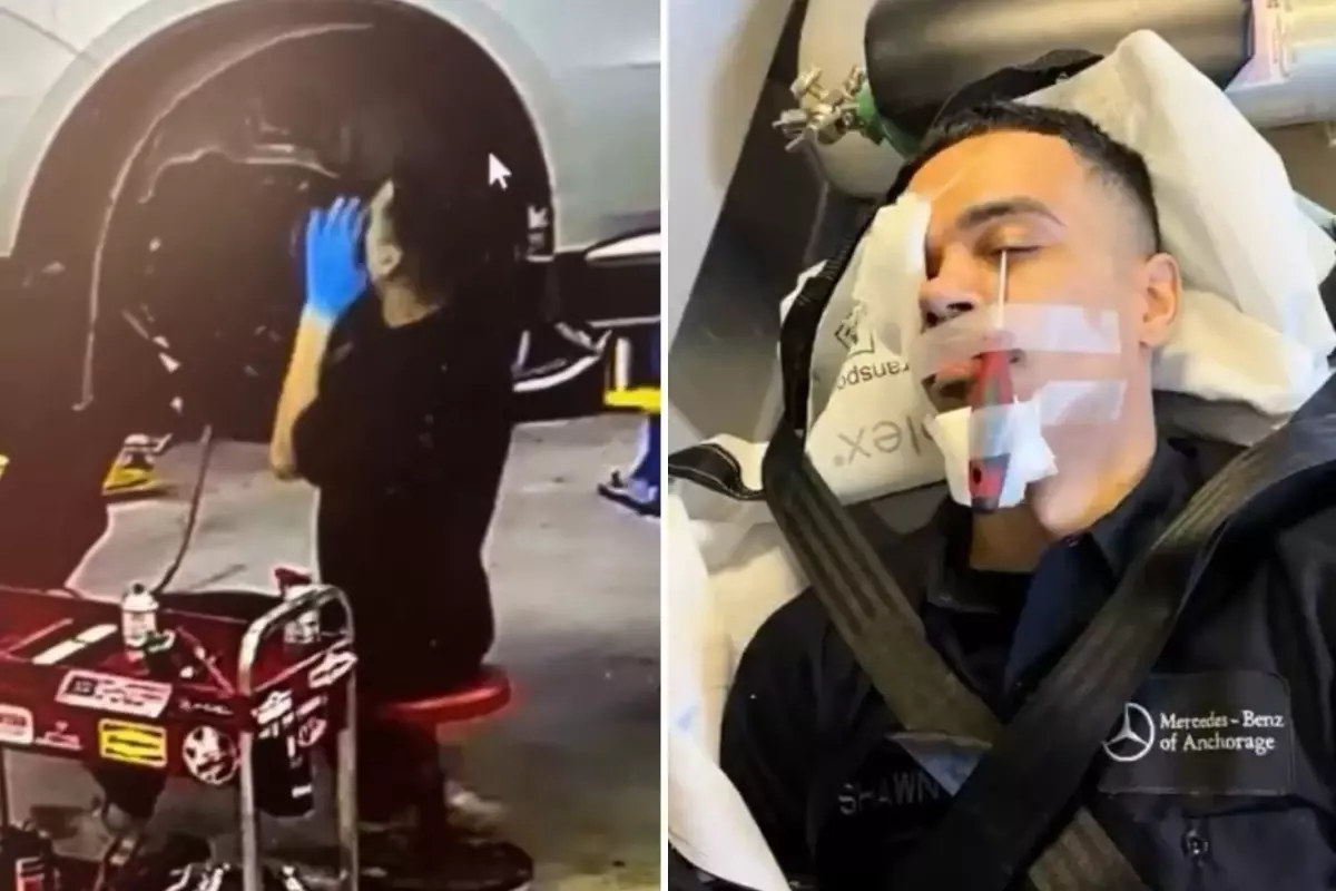 otomobil tamirinde korkutan kaza iscinin gozune tornavida saplandi Lc2Oe9Ht